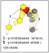 Подпись: 
1 - розтягування зв'язок;
2 - розтягування м'язів і сухожиль

